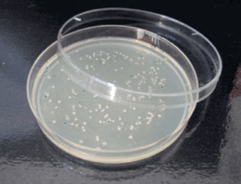 Petri dish with bacterial colonies growing in a hazardous substrate (Photo courtesy of Dr. Mohammed Bakkali, Department of Genetics, University of Granada).